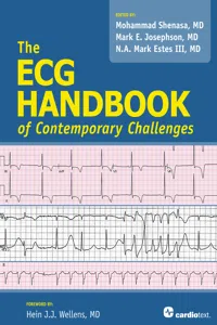 The ECG Handbook of Contemporary Challenges_cover