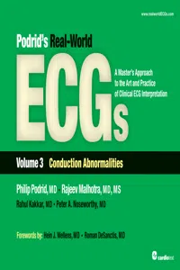 Podrid's Real-World ECGs: Volume 3, Conduction Abnormalities_cover