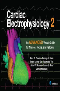 Cardiac Electrophysiology 2: An Advanced Visual Guide for Nurses, Techs, and Fellows_cover