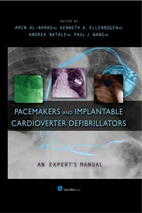 Pacemakers and Implantable Cardioverter Defibrillators: An Expert's Manual_cover