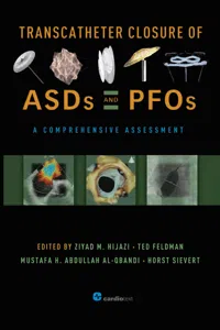 Transcatheter Closure of ASDs and PFOs : A Comprehensive Assessment_cover