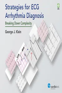 Strategies for ECG Arrhythmia Diagnosis_cover