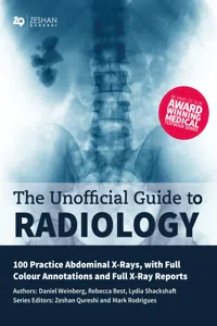 Unofficial Guide to Radiology: 100 Practice Abdominal X-Rays_cover