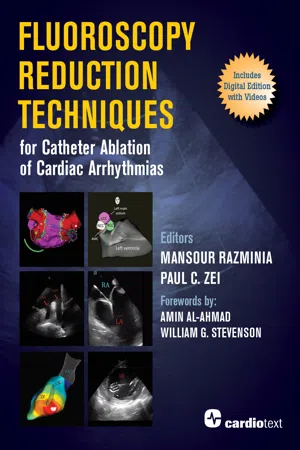 Fluoroscopy Reduction Techniques for Catheter Ablation of Cardiac Arrhythmias