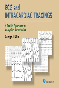 ECG and Intracardiac Tracings_cover