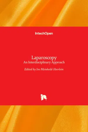 Laparoscopy