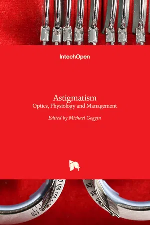 Astigmatism