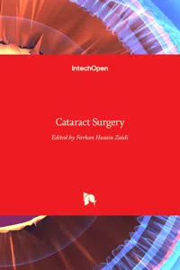 Cataract Surgery_cover