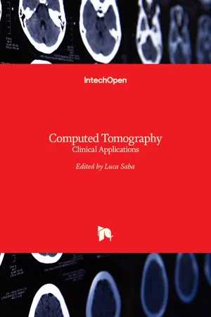 Computed Tomography