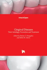 Gingival Diseases_cover