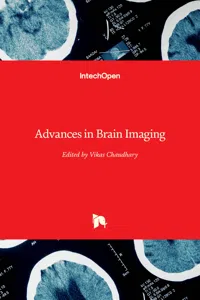 Advances in Brain Imaging_cover