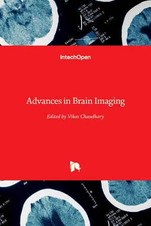 Advances in Brain Imaging