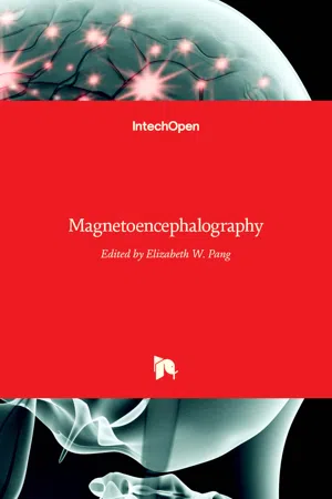 Magnetoencephalography