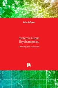 Systemic Lupus Erythematosus_cover