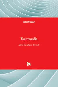Tachycardia_cover