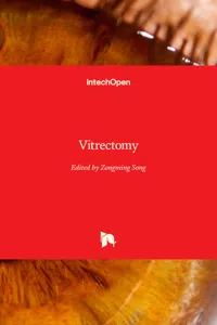 Vitrectomy_cover