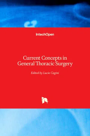 Current Concepts in General Thoracic Surgery