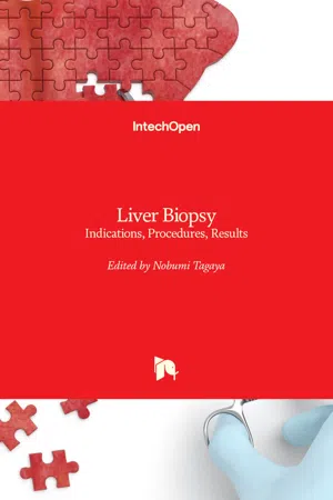 Liver Biopsy