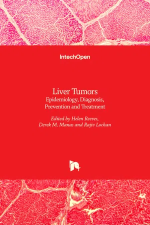 Liver Tumors