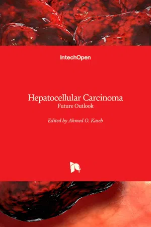 Hepatocellular Carcinoma