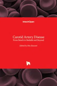 Carotid Artery Disease_cover