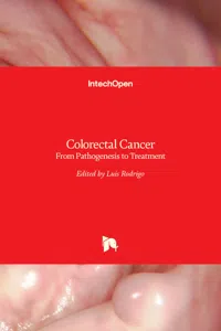 Colorectal Cancer_cover