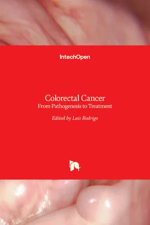 Colorectal Cancer