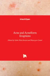 Acne and Acneiform Eruptions_cover