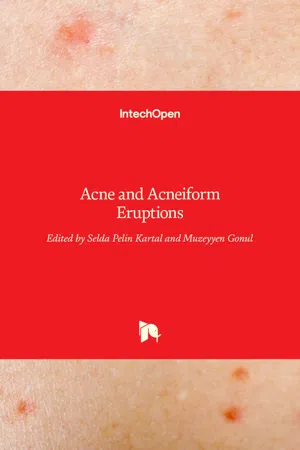 Acne and Acneiform Eruptions