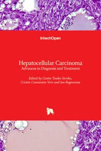 Hepatocellular Carcinoma_cover