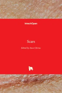 Scars_cover