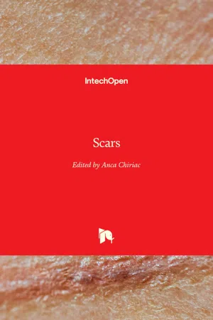 Scars