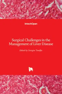 Surgical Challenges in the Management of Liver Disease_cover