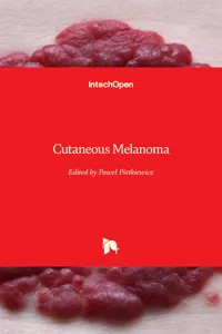 Cutaneous Melanoma_cover