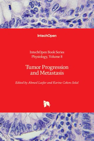Tumor Progression and Metastasis