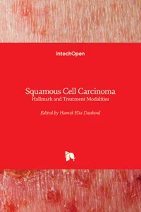 Squamous Cell Carcinoma_cover