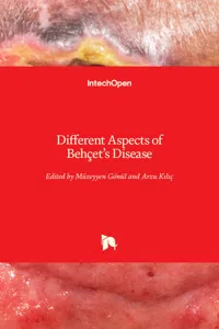 Different Aspects of Behçet's Disease_cover