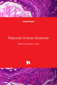 Polycystic Ovarian Syndrome_cover