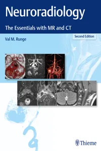 Neuroradiology_cover