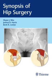 Synopsis of Hip Surgery_cover