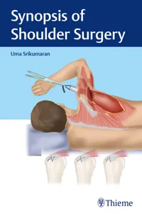 Synopsis of Shoulder Surgery_cover