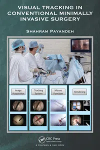 Visual Tracking in Conventional Minimally Invasive Surgery_cover