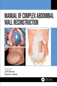 Manual of Complex Abdominal Wall Reconstruction_cover