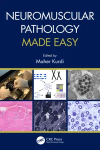 Neuromuscular Pathology Made Easy_cover
