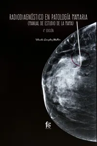 Radiodiagnóstico en patología mamaria_cover