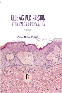ÚLCERAS POR PRESIÓN_cover