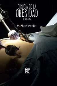 CIRUGÍA DE LA OBESIDAD_cover