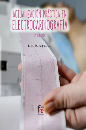 Actualización práctica en electrocardiografía