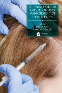 Techniques in the Evaluation and Management of Hair Diseases_cover