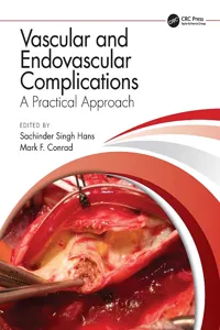 Vascular and Endovascular Complications: A Practical Approach_cover